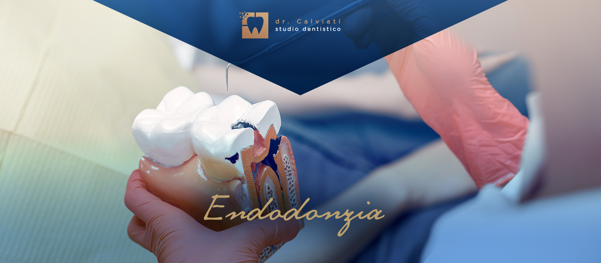 banner pag interne endodonzia